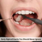 Early Signs of Cavity You Should Never Ignore