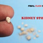 kidney stones