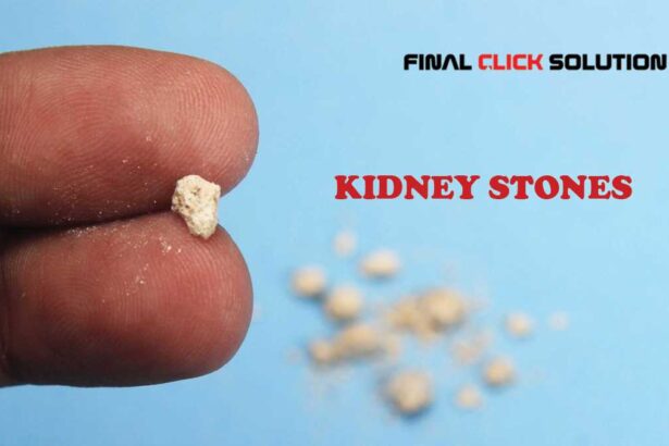 kidney stones