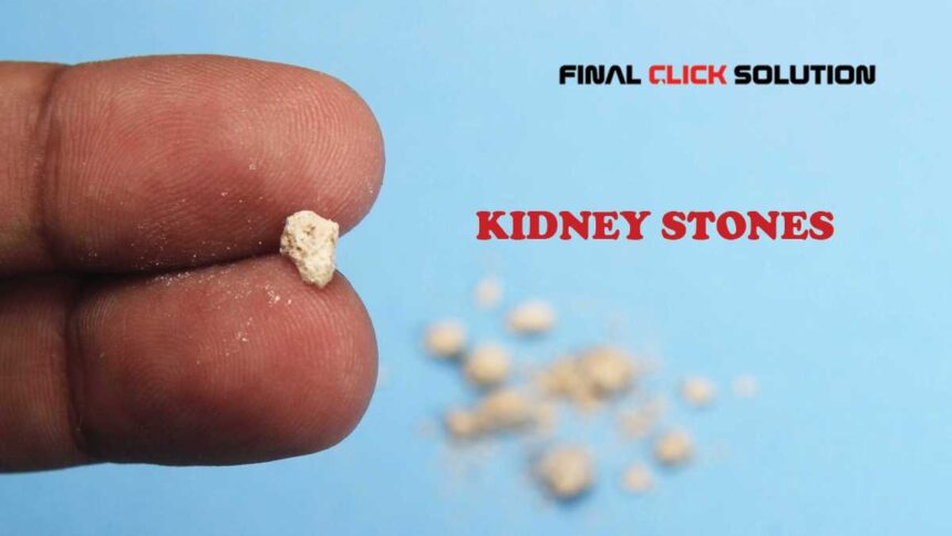 kidney stones