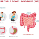 Woman holding stomach in pain from IBS symptoms