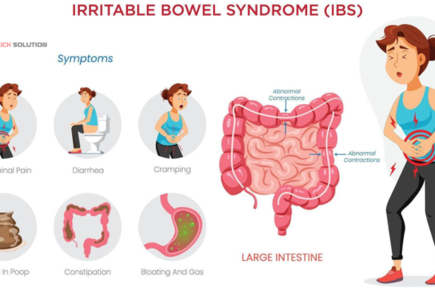 Woman holding stomach in pain from IBS symptoms