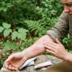 Poison Ivy Rash Treatment: What Works Fast and What to Avoid